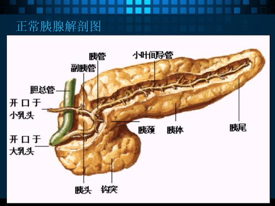 胰腺疾病的CT诊断.ppt_第3页