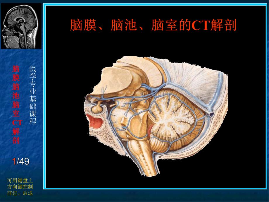 脑膜、脑池、脑室CT解剖.ppt.ppt_第1页