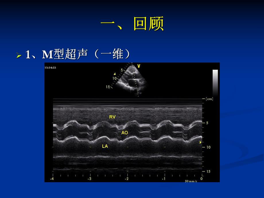 超声新进展【PPT】 .ppt_第2页