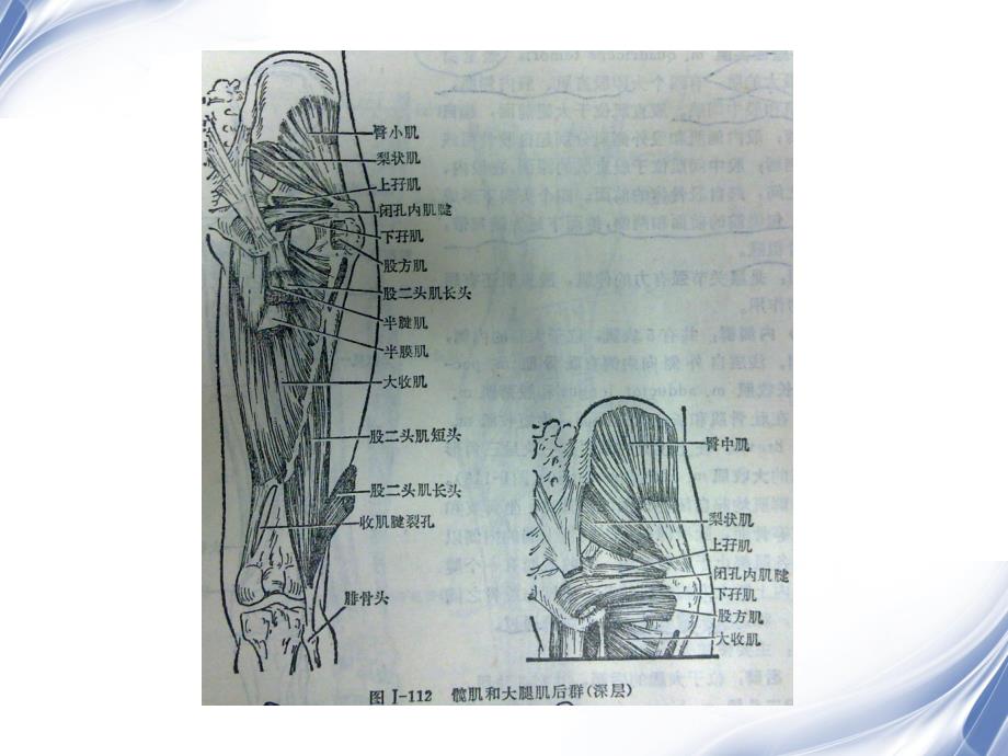 骨盆肌肉mri解剖.ppt_第2页