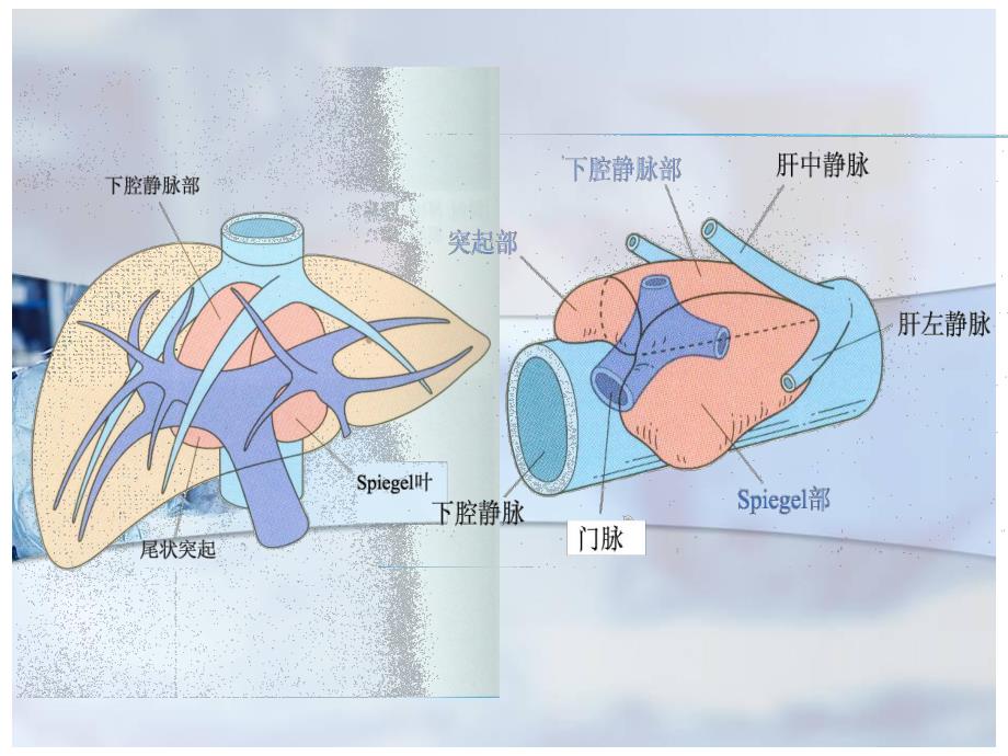 肝脏尾状叶图文.ppt_第3页