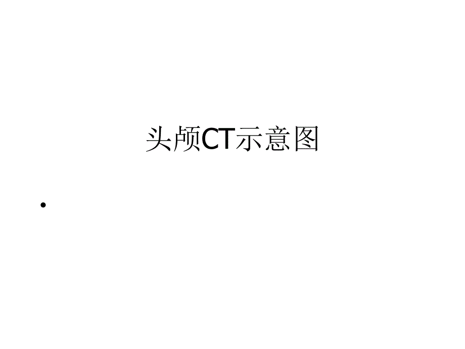 脑头颅CT示意图.ppt_第1页