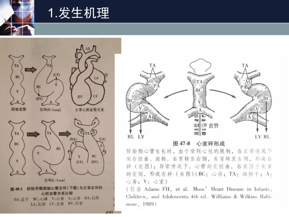 超声心动图中节段法对于大血管转位的诊断应用.ppt_第2页