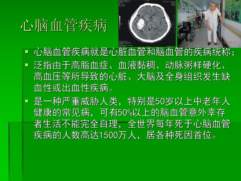 心脑血管疾病的预防.ppt_第2页