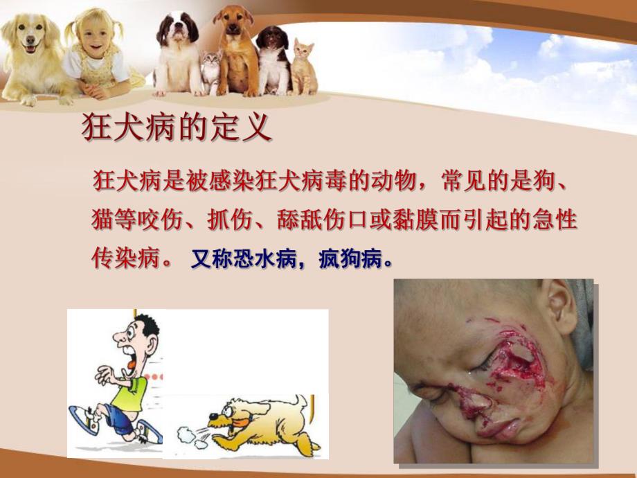 犬咬伤的急救常识与预防.ppt_第3页