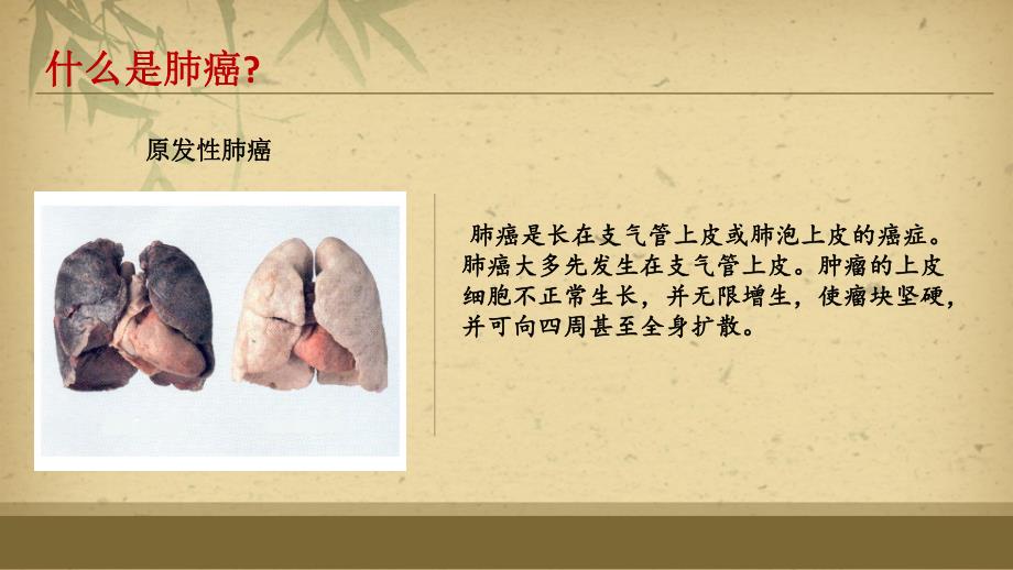 肺癌的护理.ppt_第3页