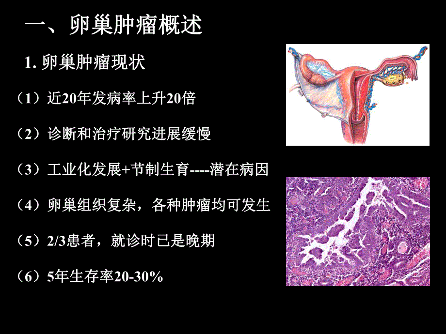 卵巢交界性肿瘤诊治进展.ppt_第3页