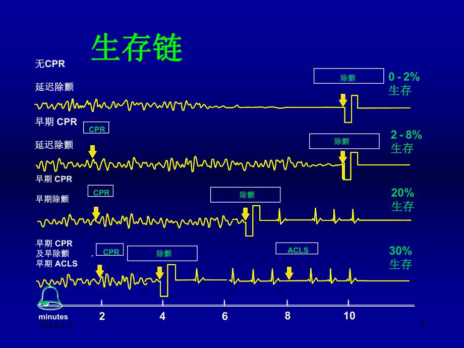 电除颤的进展1.ppt_第3页