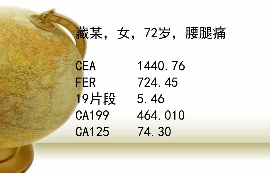 多发性肿瘤骨转移诊断与治.ppt_第2页