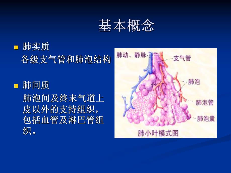 4特发性肺纤维化.ppt_第2页