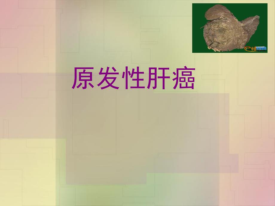 【原发性肝癌本科班课件】医学课件ppt52页.ppt_第1页