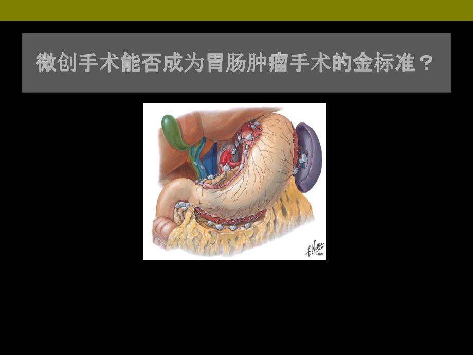 微创手术能否成为胃肠肿瘤手术的金标准？微创手术能否成为胃肠肿瘤手术的金标准？ .ppt_第1页