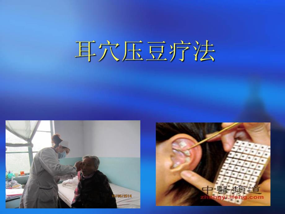 耳穴压豆疗法.ppt_第1页