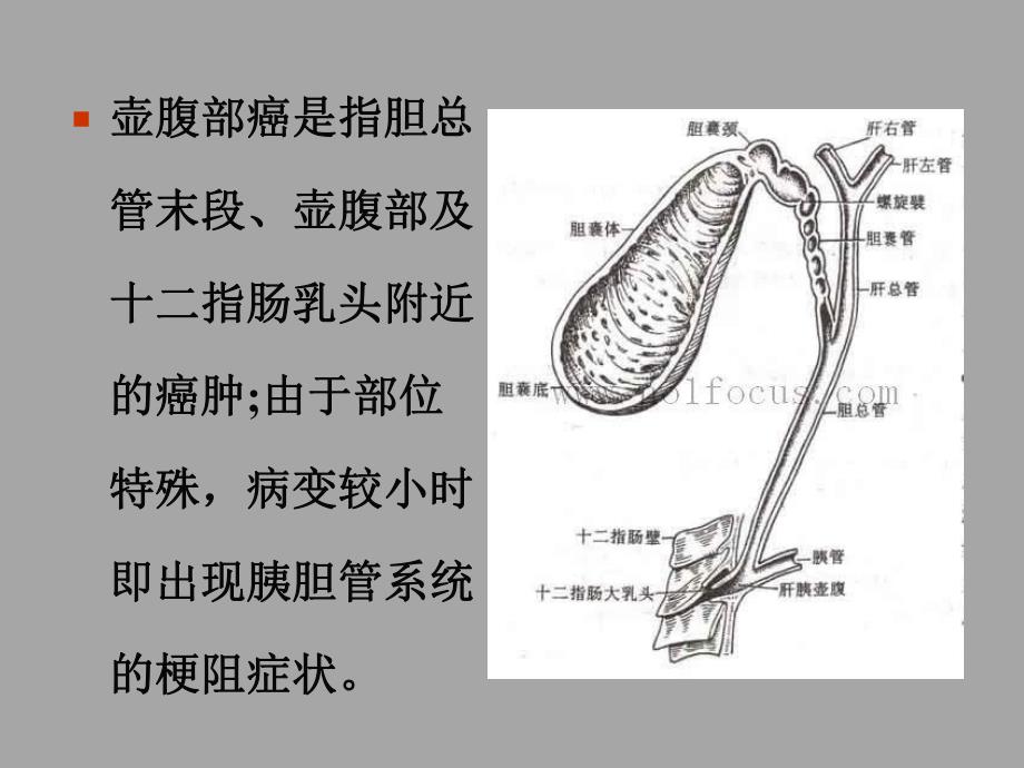 Vater壶腹癌的影像学表现及TNM分期.ppt_第2页