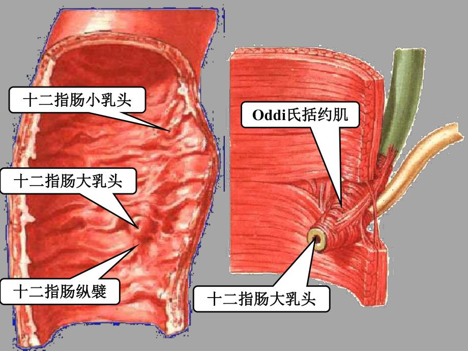 Vater壶腹癌的影像学表现及TNM分期.ppt_第3页