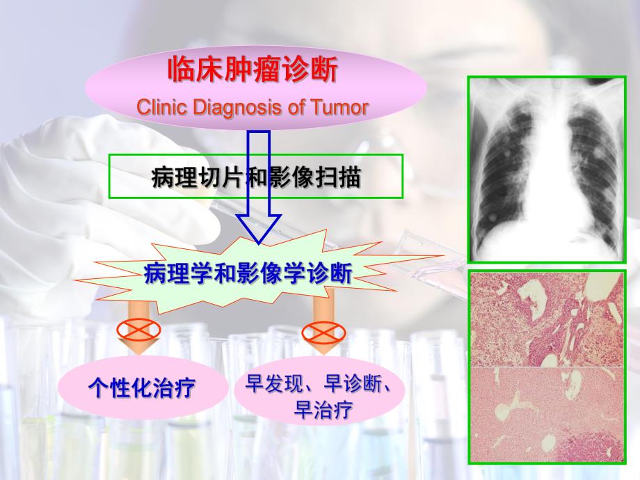 肿瘤诊断.ppt_第3页