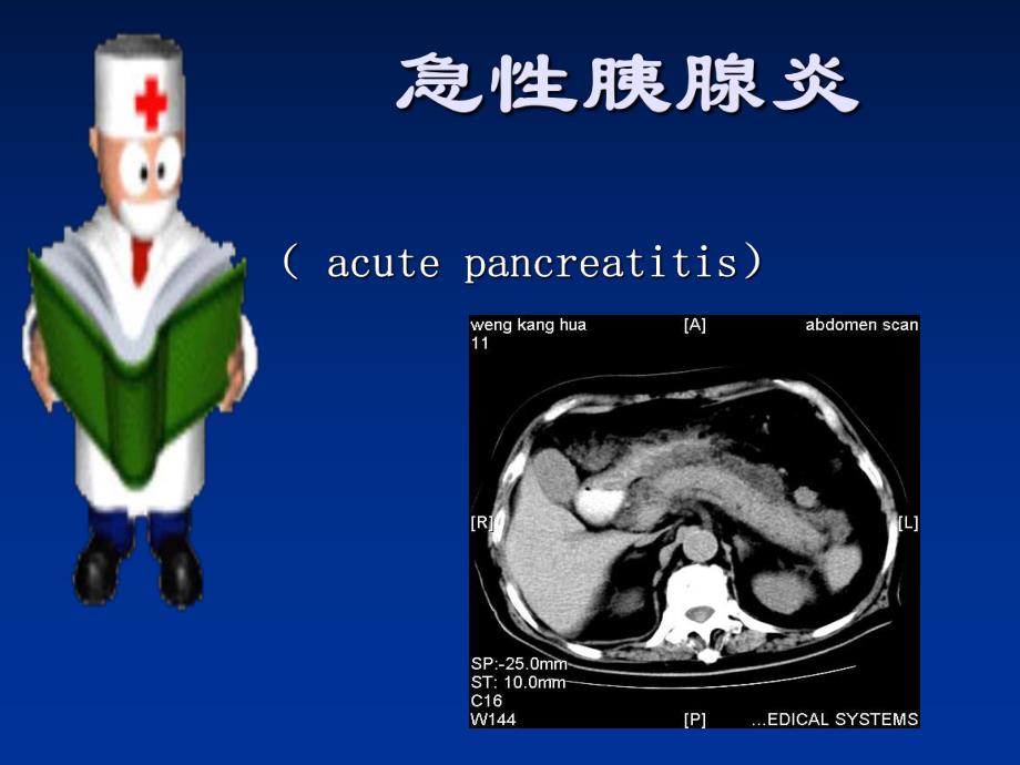 21急性胰腺炎.ppt_第1页