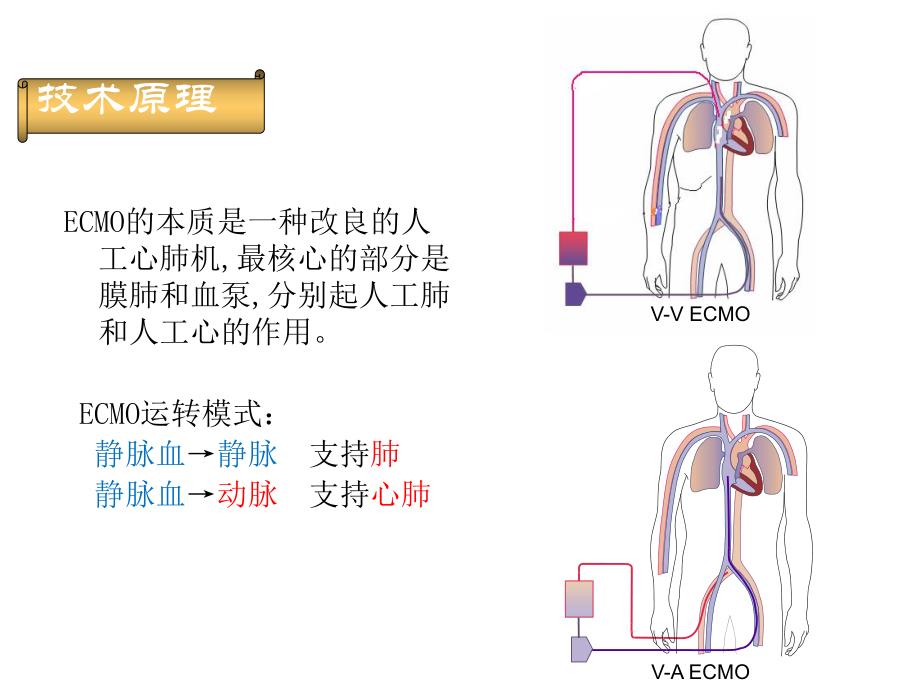 ECMO治疗危重患者进展.ppt_第3页