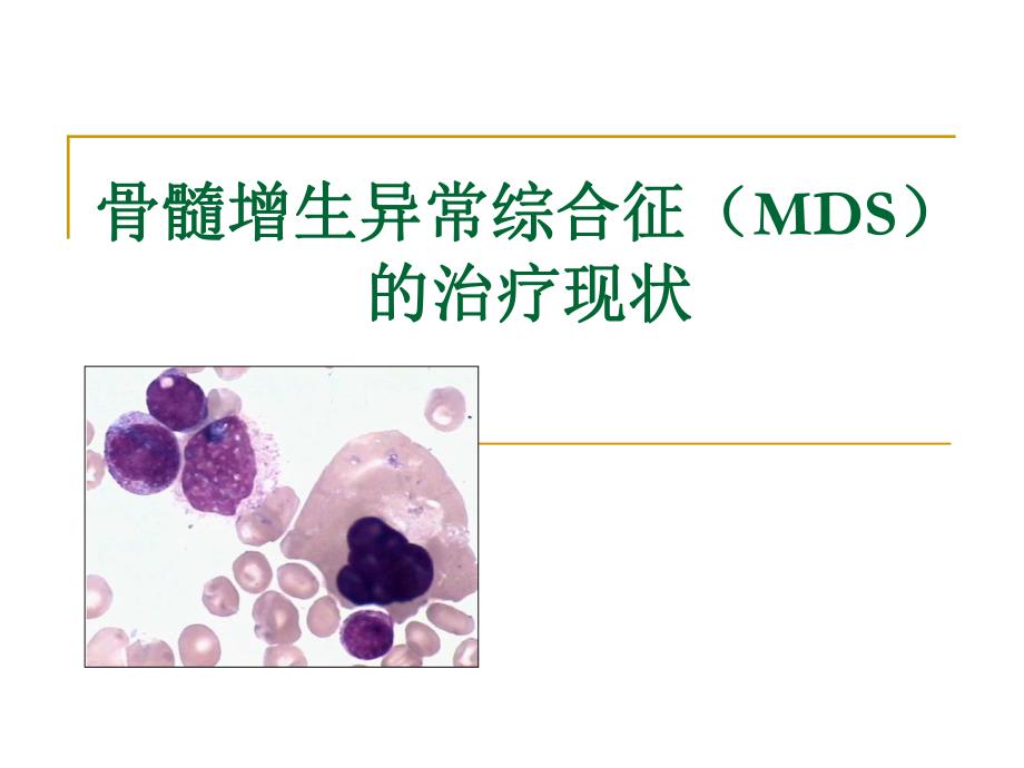 骨髓增生异常综合征MDS的诊疗现状.ppt_第1页