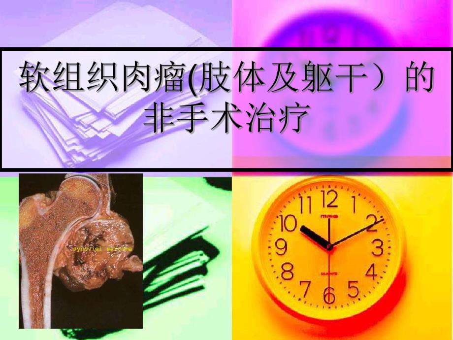 软组织肉瘤的非手术治疗.ppt_第1页