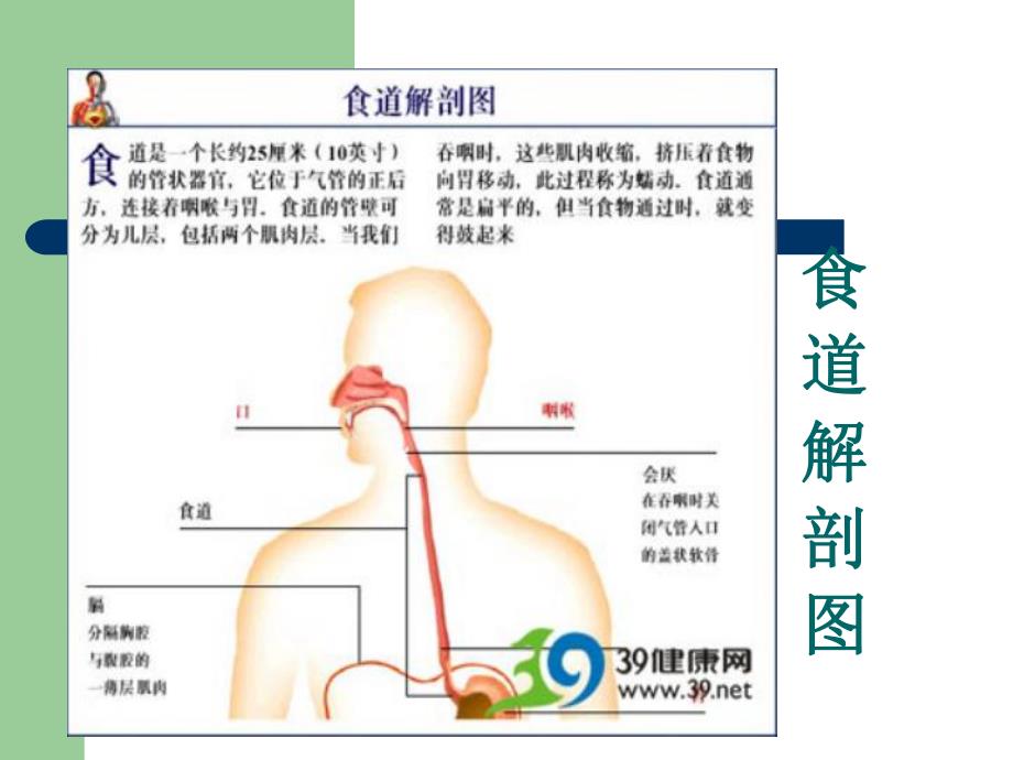 食管癌的介入治疗.ppt_第3页