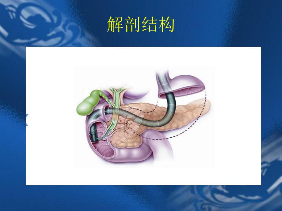 中国急性胰腺炎指南.ppt_第2页