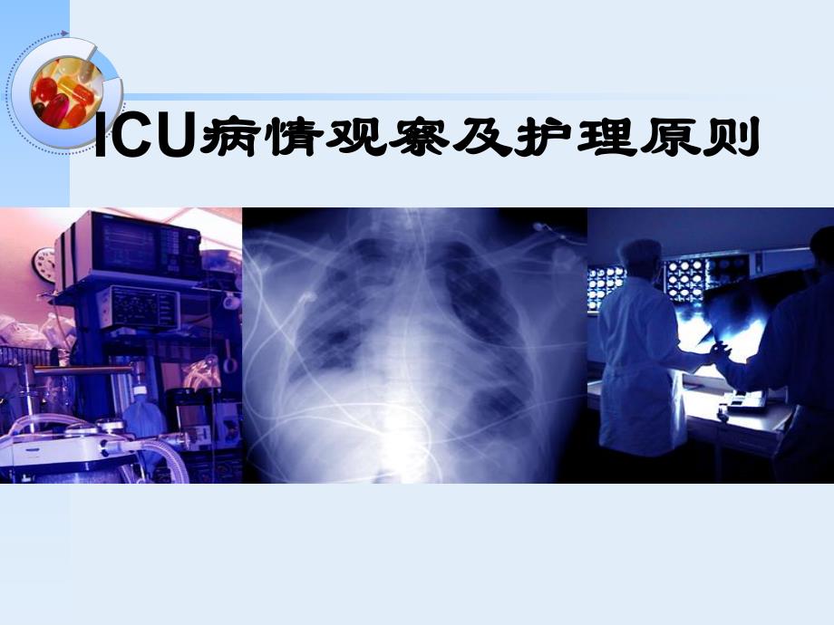 ICU病情观察及护理原则.ppt_第1页