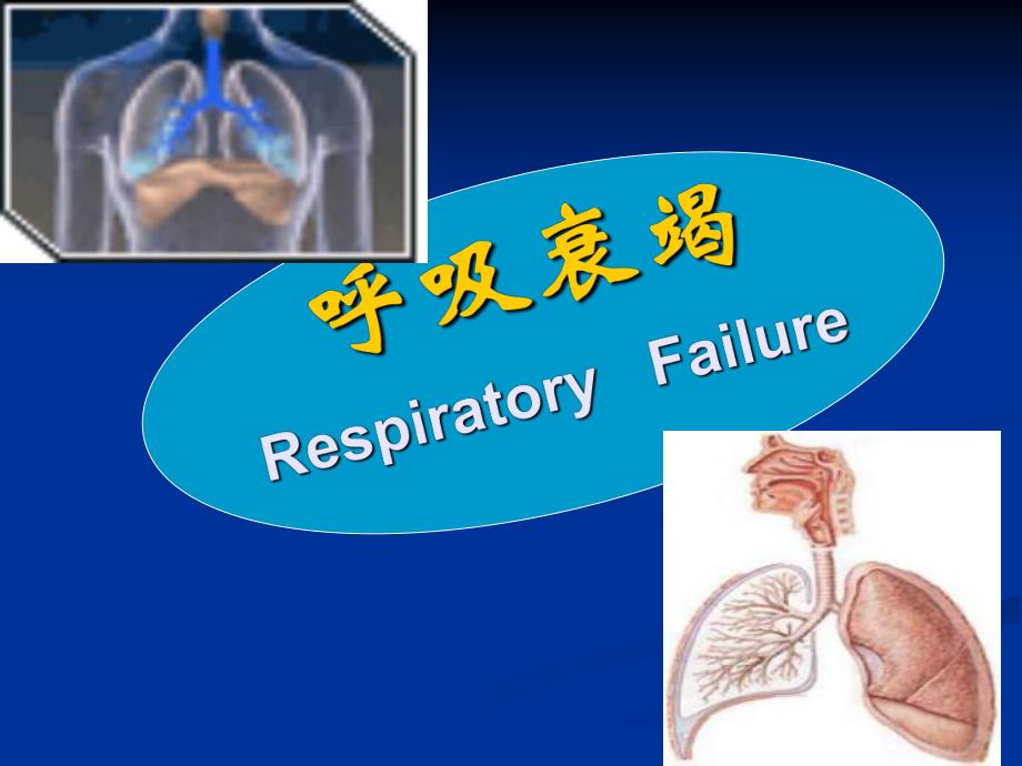 呼吸衰竭1.ppt_第1页