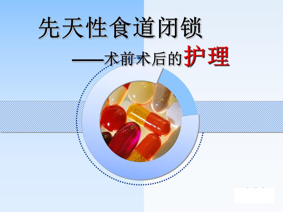 食道闭锁.ppt.ppt_第1页