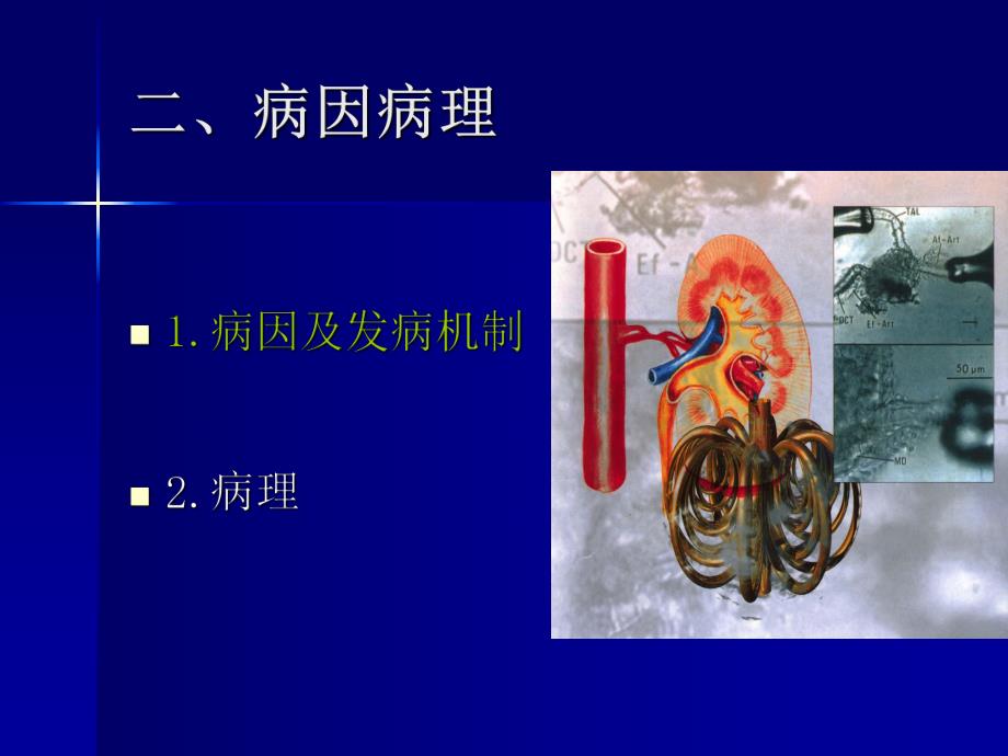 急性肾功能衰竭2.ppt_第3页