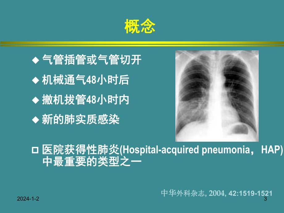 呼吸机相关性肺炎.ppt_第3页