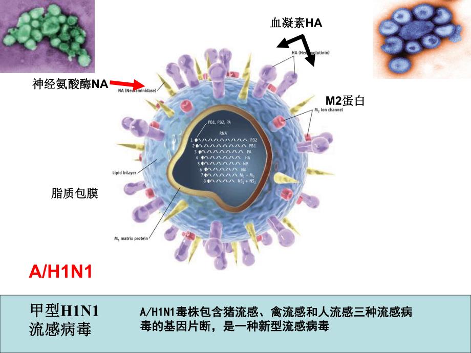 甲型H1N1流感重症患者 监护及管理.ppt_第3页