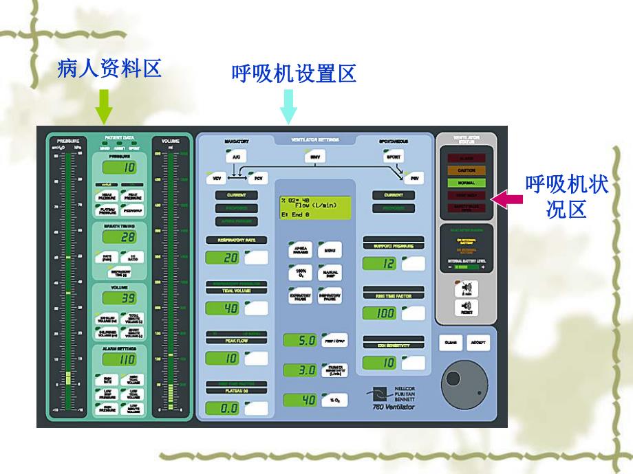 呼吸机在急诊中的应用.ppt_第3页