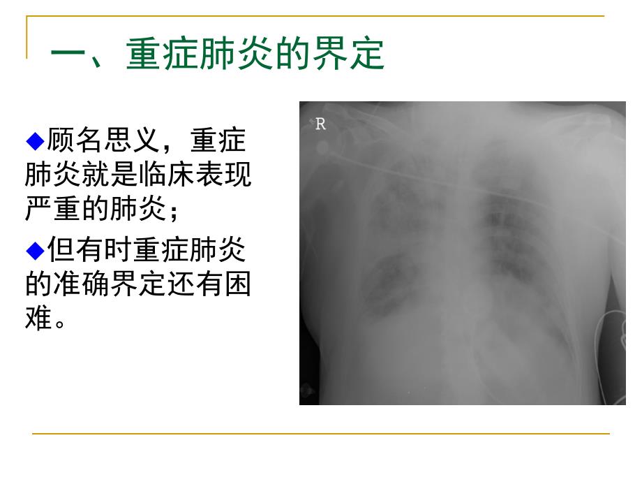 重症肺炎的诊断与治疗.ppt_第3页