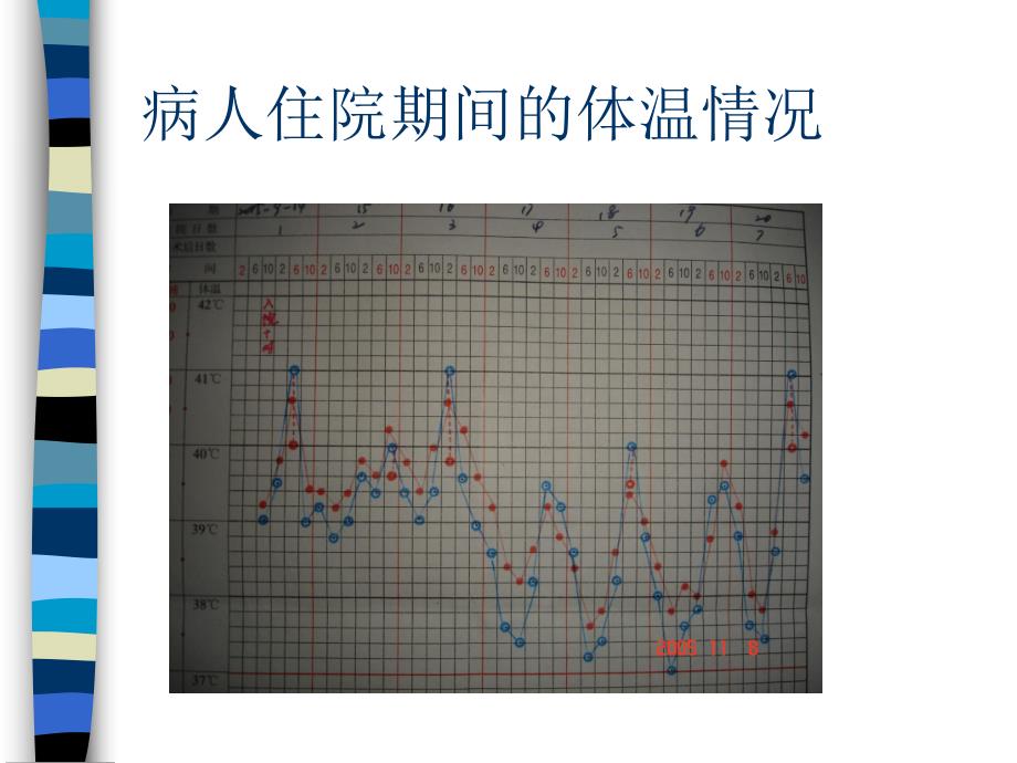 儿科病例讨论.ppt_第3页