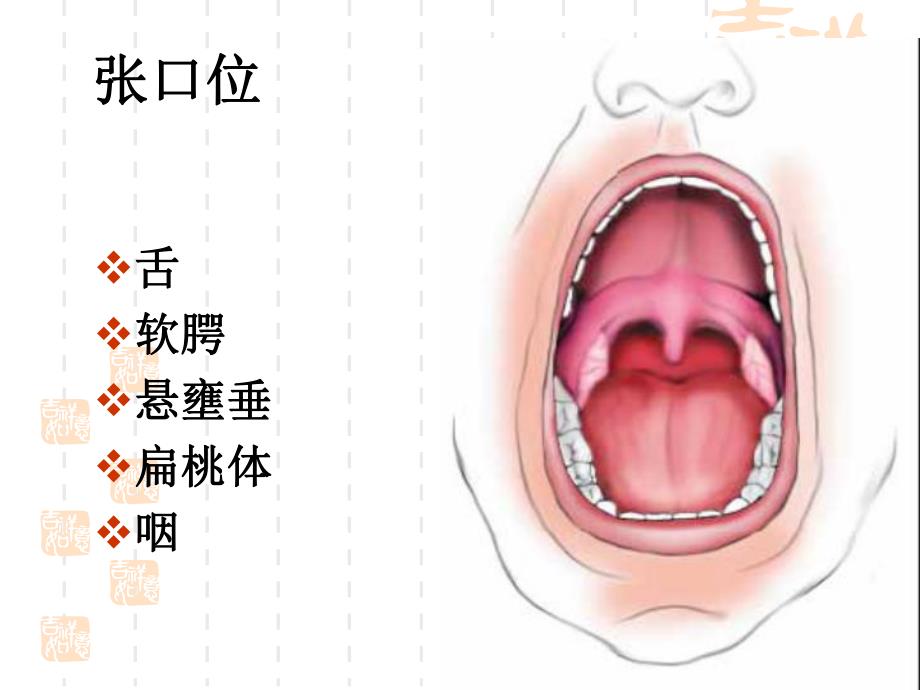 气道阻塞的急救.ppt_第3页