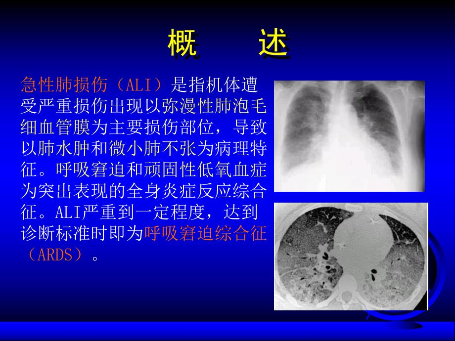 急性肺损伤和ARDS.ppt_第3页