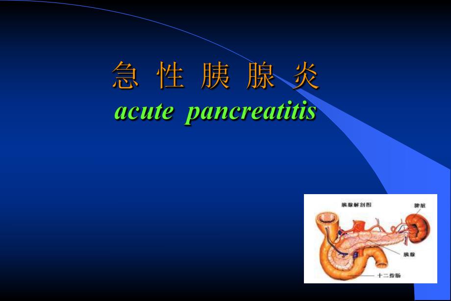 急性胰腺炎.ppt_第1页