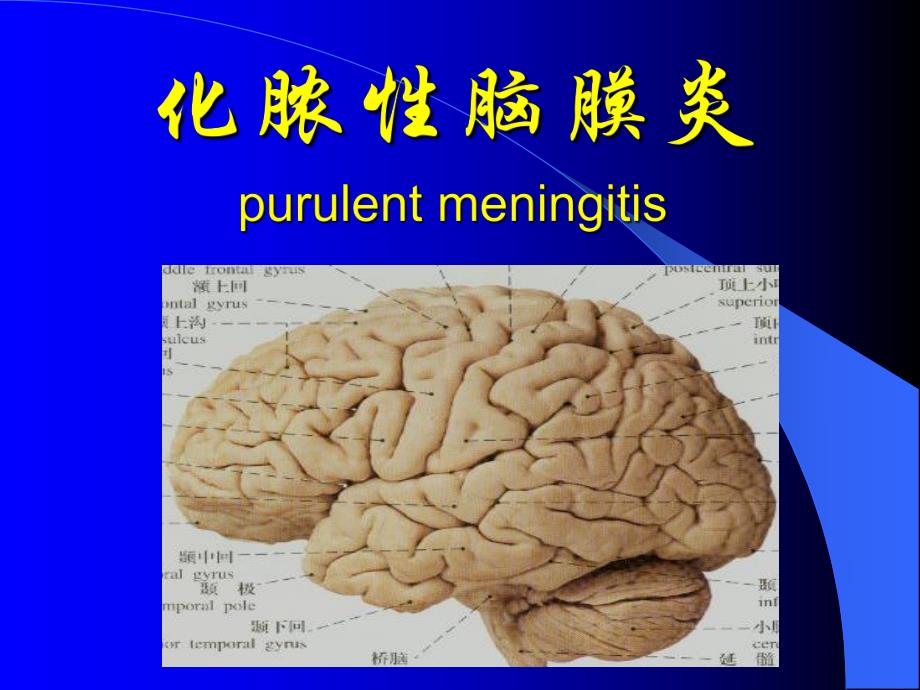 化脓性脑膜炎1.ppt_第1页