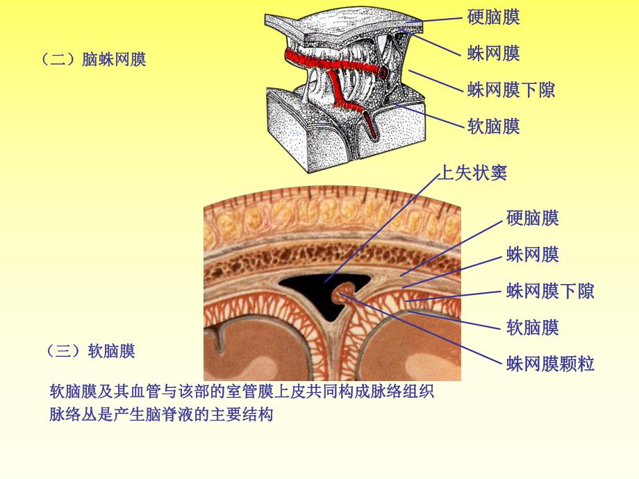 化脓性脑膜炎的MRI诊断.ppt_第2页