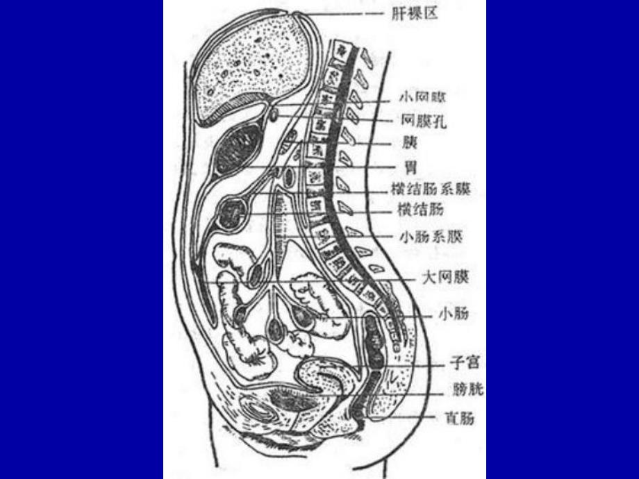 急性化脓性腹膜炎.ppt_第3页