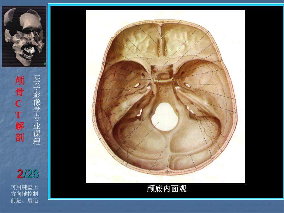 头颈部断层解剖.ppt_第2页