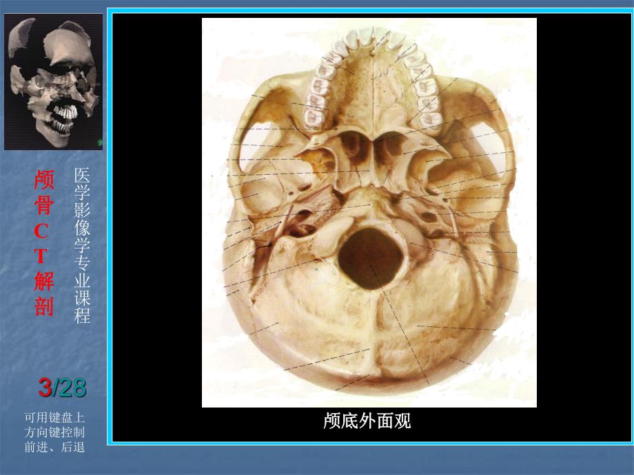 头颈部断层解剖.ppt_第3页