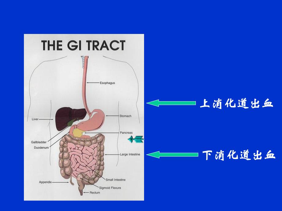 上消化道出血PPT.ppt_第2页