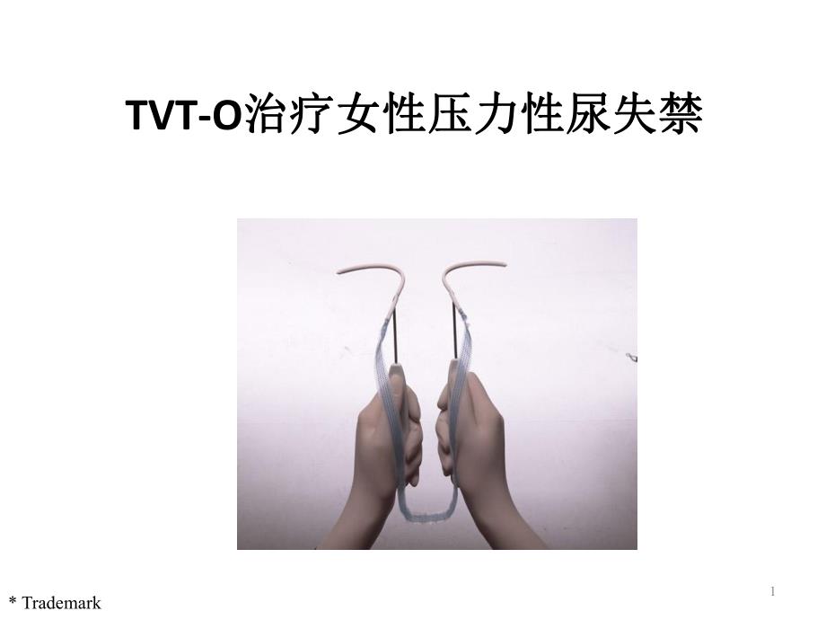 TVTO治疗女性压力性尿失禁.ppt_第1页