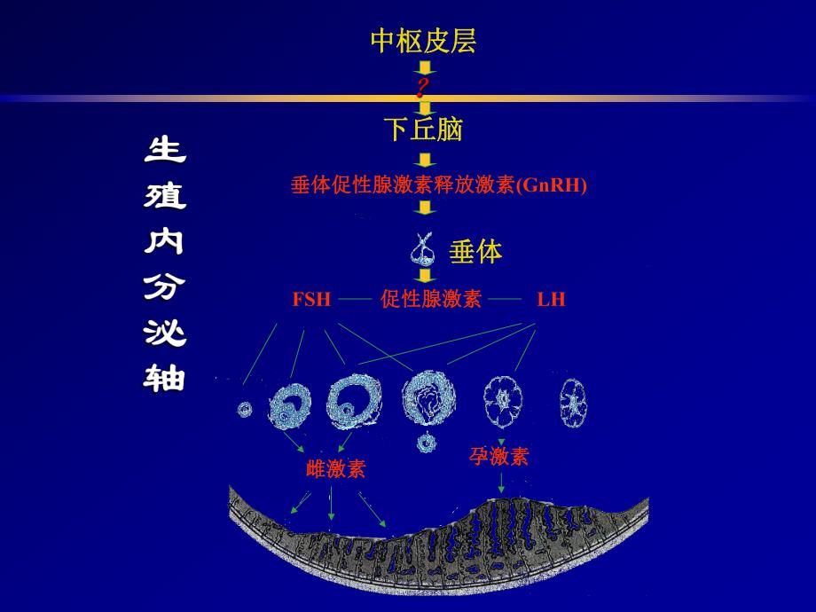 多囊卵巢综合征的病因、诊断及治疗.ppt_第2页