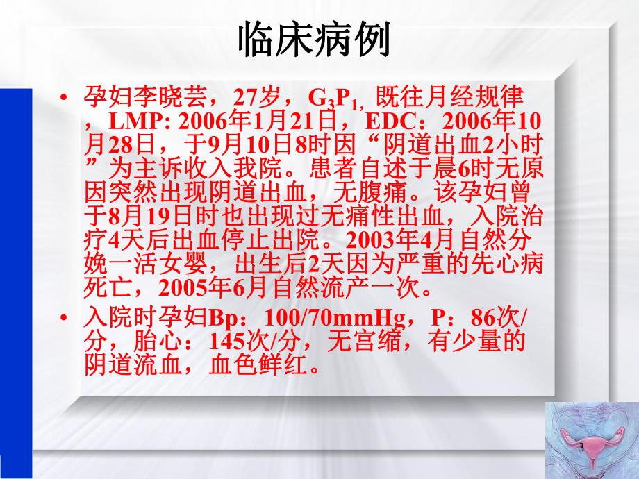 前置胎盘.ppt_第3页