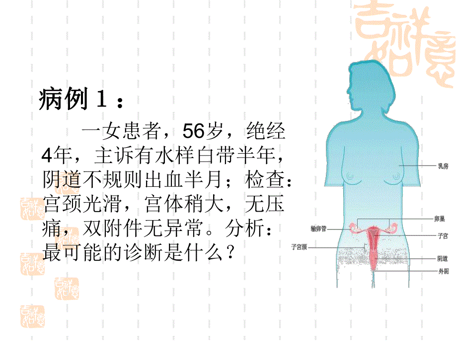 子宫内膜癌.ppt_第3页