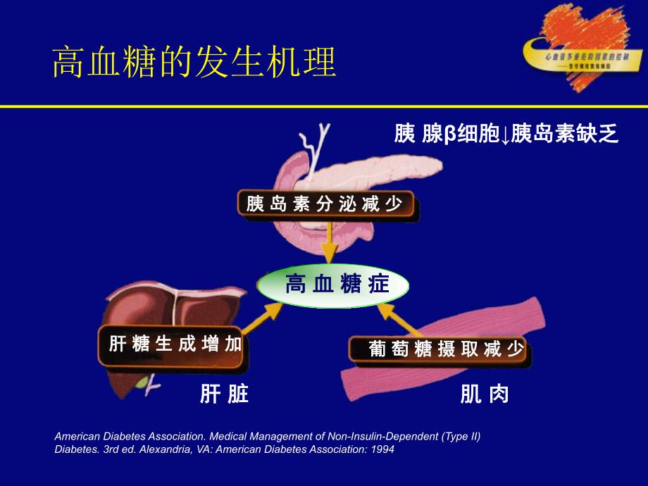 妊娠糖尿病.ppt.ppt_第3页