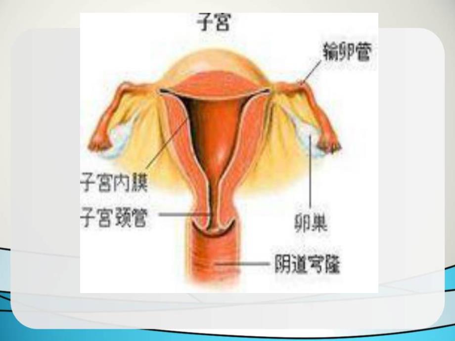 产后出血.ppt_第3页